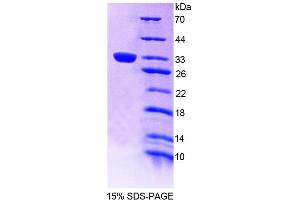 SDS-PAGE (SDS) image for Tec Protein Tyrosine Kinase (TEC) (AA 370-623) protein (His tag) (ABIN6239124)