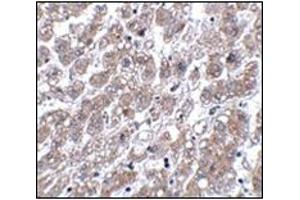 Immunohistochemistry of MATN1 in human liver tissue with this product at 5 μg/ml. (MATN1 抗体  (C-Term))