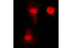Immunofluorescent analysis of SNAI1 staining in HEK293T cells. (SNAIL 抗体  (C-Term))
