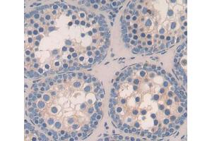 Used in DAB staining on fromalin fixed paraffin- embedded testis tissue (TOPBP1 抗体  (AA 1-246))