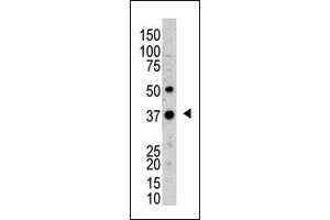 The anti-UCHL5 Pab (ABIN388873 and ABIN2839168) is used in Western blot to detect UCHL5 in mouse kidney tissue lysate. (UCHL5 抗体  (N-Term))