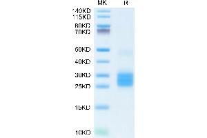 IL-25 Protein (AA 33-177) (His tag)