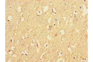 Immunohistochemistry of paraffin-embedded human brain tissue using ABIN7167338 at dilution of 1:100 (RAB4B 抗体  (AA 1-278))