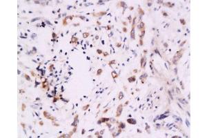 Immunohistochemistry (Paraffin-embedded Sections) (IHC (p)) image for anti-V-Set Domain Containing T Cell Activation Inhibitor 1 (VTCN1) (AA 50-100) antibody (ABIN671736)