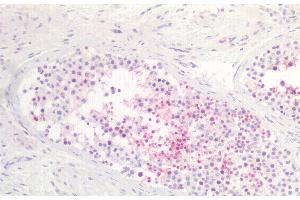 Immunohistochemistry (IHC) image for anti-Solute Carrier Family 16, Member 10 (Aromatic Amino Acid Transporter) (SLC16A10) (AA 664-970) antibody (ABIN7441175)