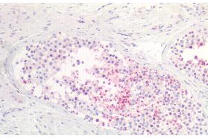 Detection of TAT1 in Human Testis Tissue using Polyclonal Antibody to Testis Anion Transporter 1 (TAT1) (SLC26A8 抗体  (AA 664-970))