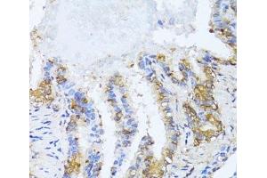 Immunohistochemistry of paraffin-embedded Rat lung using NAT2 Polyclonal Antibody at dilution of 1:100 (40x lens). (NAT2 抗体)
