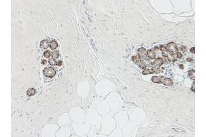 Formalin-Fixed Paraffin-Embedded Sections of Human breast lobular carcinoma in situ using Maspin Antibody Cat.