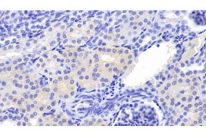 Detection of Cys-C in Porcine Kidney Tissue using Polyclonal Antibody to Cystatin C (Cys-C) (CST3 抗体  (AA 42-127))