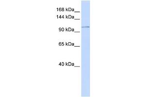 Western Blotting (WB) image for anti-ATPase, Ca++ Transporting, Plasma Membrane 3 (ATP2B3) (N-Term) antibody (ABIN2781843)
