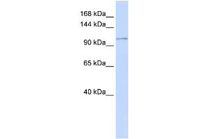 WB Suggested Anti-ATP2B3 Antibody Titration:  0. (ATP2B3 抗体  (N-Term))