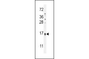 TCL6 Antibody (C-term) (ABIN654803 and ABIN2844478) western blot analysis in HL-60 cell line lysates (35 μg/lane). (TCL6 抗体  (C-Term))