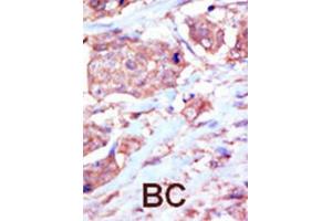 Immunohistochemistry (IHC) image for anti-EPH Receptor B6 (EPHB6) antibody (ABIN3003353) (EPH Receptor B6 抗体)