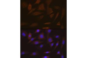 Immunofluorescence analysis of NIH-3T3 cells using SMC4 Rabbit mAb (ABIN7270618) at dilution of 1:100 (40x lens). (SMC4 抗体)