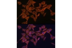 Immunofluorescence analysis of NIH-3T3 cells using Syntaxin 4 Rabbit mAb (ABIN7270687) at dilution of 1:100 (40x lens). (Syntaxin 4 抗体)