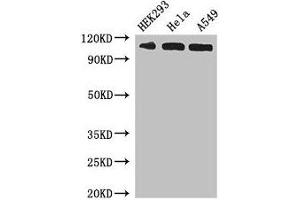 Western Blot Positive WB detected in: HEK293 whole cell lysate, Hela whole cell lysate, A549 whole cell lysate All lanes: IPO13 antibody at 3 μg/mL Secondary Goat polyclonal to rabbit IgG at 1/50000 dilution Predicted band size: 109 kDa Observed band size: 109 kDa (IPO13 抗体  (AA 501-700))