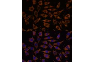 Immunofluorescence analysis of L929 cells using EIF5B antibody (ABIN7267052) at dilution of 1:100.
