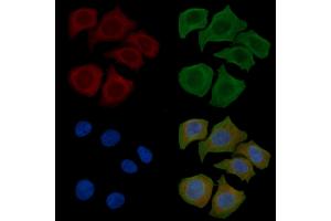 ABIN6260240 and ABIN6269134 staining Hela cells(45 min of heat-shock) by IF/ICC. (BCR 抗体  (N-Term))