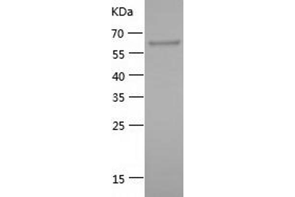 HSP90AA1 Protein (AA 381-732) (His-IF2DI Tag)