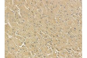 ABIN6262960 and ABIN6273263 at 1/100 staining human normal liver tissue by IHC-P. (EIF2D 抗体  (Internal Region))