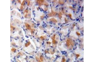 Used in DAB staining on fromalin fixed paraffin-embedded stomach tissue (SHC1 抗体  (AA 272-559))
