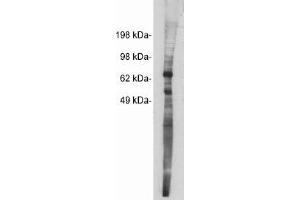 Image no. 1 for anti-Netrin 1 (NTN1) antibody (ABIN265184) (Netrin 1 抗体)
