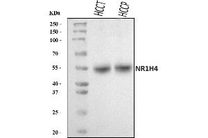 Western blot analysis of NR1H4 using anti-NR1H4 antibody (ABIN5518940).