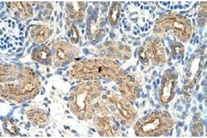 Immunohistochemical staining (Formalin-fixed paraffin-embedded sections) of human kidney with CTDSPL polyclonal antibody  at 4-8 ug/mL working concentration. (CTDSPL 抗体  (N-Term))