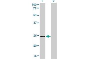 Western Blotting (WB) image for anti-Clathrin, Light Chain B (CLTB) (AA 1-212) antibody (ABIN598618) (CLTB 抗体  (AA 1-212))