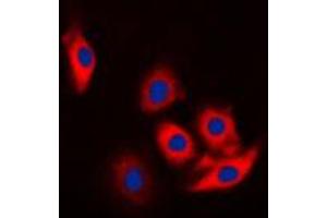 Immunofluorescent analysis of c-CBL (pY774) staining in Jurkat cells. (CBL 抗体  (C-Term, pTyr774))