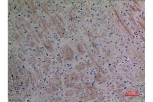 Immunohistochemistry (IHC) analysis of paraffin-embedded Mouse Brain, antibody was diluted at 1:100. (CCL26 抗体  (Internal Region))