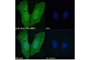 ABIN184943 Immunofluorescence analysis of paraformaldehyde fixed U2OS cells, permeabilized with 0. (TRAK2 抗体  (C-Term))