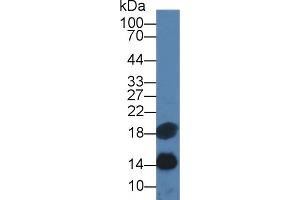 Detection of SAA in Human Serum using Monoclonal Antibody to Serum Amyloid A (SAA) (SAA 抗体  (AA 19-122))