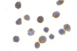 Immunocytochemistry of TSC1 in EL4 cells with this product at 2 μg/ml (TSC1 抗体  (both Isoforms, Middle Region))