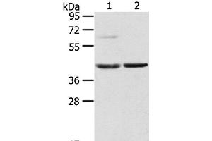 Western Blot analysis of Mouse brain and liver tissue using HIF1AN Polyclonal Antibody at dilution of 1:200 (HIF1AN 抗体)