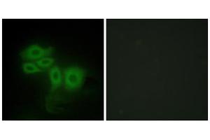 Immunofluorescence analysis of HepG2 cells, using SLK antibody. (SLK 抗体  (C-Term))