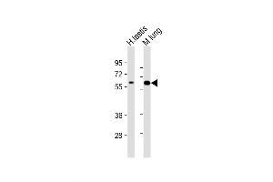 Western Blot at 1:2000 dilution Lane 1: human testis lysate Lane 2: mouse lung lysate Lysates/proteins at 20 ug per lane. (TGFBR2 抗体  (N-Term))