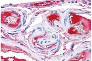 Human Small Intestine, Vessels (formalin-fixed, paraffin-embedded) stained with F12 antibody ABIN337368 at 5 ug/ml followed by biotinylated anti-goat IgG secondary antibody ABIN481715, alkaline phosphatase-streptavidin and chromogen. (F12 抗体)