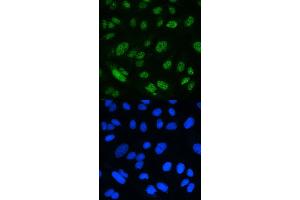 IF analysis of MSH2 using anti-MSH2 antibody (ABIN3043885). (MSH2 抗体  (AA 337-583))