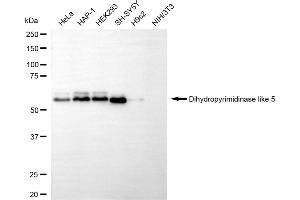 Western blotting analysis using dihydropyrimidinase like 5 antibody (ABIN7798340). (DPYSL5 抗体)