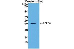Western Blotting (WB) image for anti-Fibroblast Growth Factor 21 (FGF21) (AA 29-209) antibody (ABIN3204835) (FGF21 抗体  (AA 29-209))
