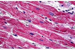 Immunohistochemistry (Formalin-fixed Paraffin-embedded Sections) (IHC (fp)) image for anti-Sprouty Homolog 1, Antagonist of FGF Signaling (SPRY1) (AA 1-111) antibody (ABIN626082)