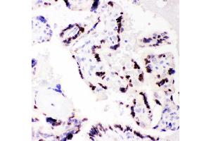 Anti- CEBP Beta Picoband antibody, IHC(P) IHC(P): Human Placenta Tissue (CEBPB 抗体  (AA 1-200))