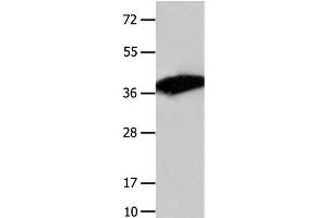 Western Blot analysis of Mouse liver tissue using COPS5 Polyclonal Antibody at dilution of 1:1550 (COPS5 抗体)