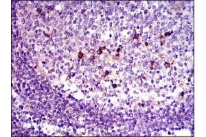 Image no. 1 for anti-Transforming Growth Factor, beta 1 (TGFB1) antibody (ABIN1491617) (TGFB1 抗体)