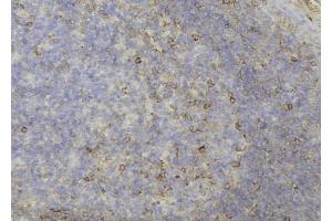 ABIN6273689 at 1/100 staining Human lymph node tissue by IHC-P. (KRT81 抗体  (C-Term))