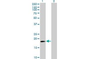 Western Blot analysis of TNFAIP8 expression in transfected 293T cell line by TNFAIP8 MaxPab polyclonal antibody. (TNFAIP8 抗体  (AA 1-190))