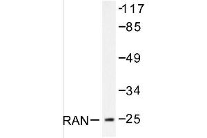 Image no. 1 for anti-RAN, Member RAS Oncogene Family (RAN) antibody (ABIN271799) (RAN 抗体)