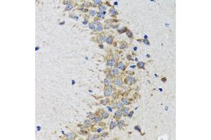 Immunohistochemistry of paraffin-embedded rat brain using CDK1 antibody. (CDK1 抗体  (AA 208-258))