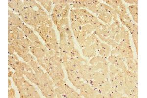 Immunohistochemistry of paraffin-embedded human heart tissue using ABIN7145462 at dilution of 1:100 (CRYBA1 抗体  (AA 1-215))